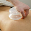 CUPPING MASSAGE 30/60/90 mins